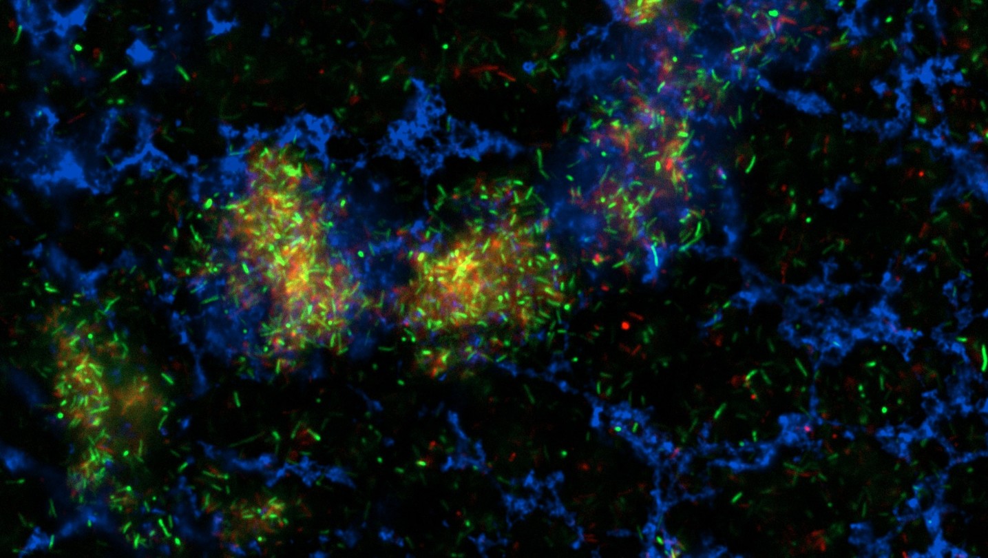 Immunofluorescence 분석